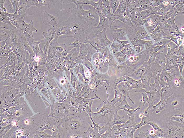 人小胶质细胞图片