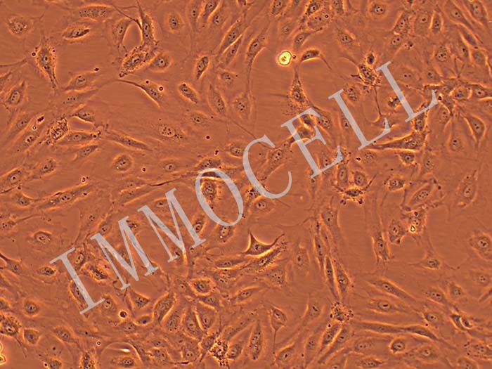 人淋巴管细胞细胞图片