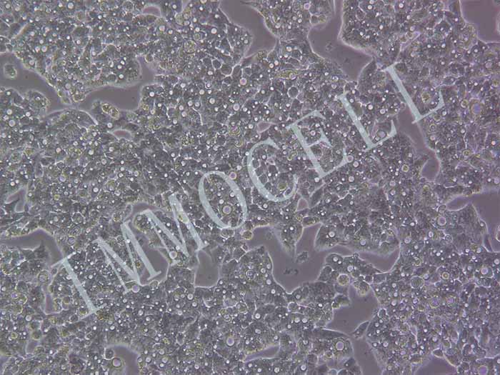 HEPG2细胞细胞图片