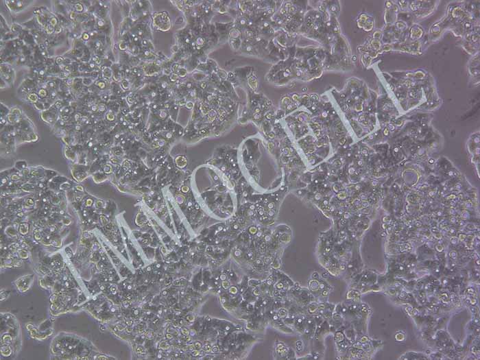 GS-HEPG2细胞图片
