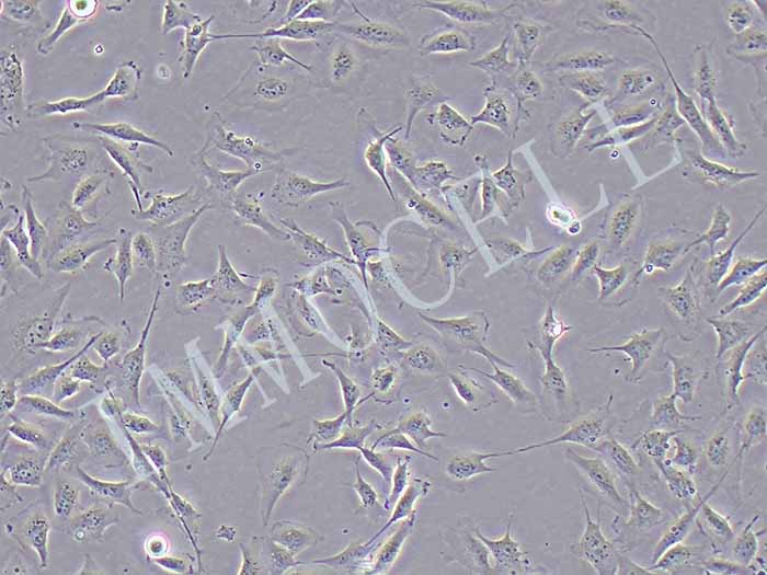 HCMEC/D3细胞细胞图片