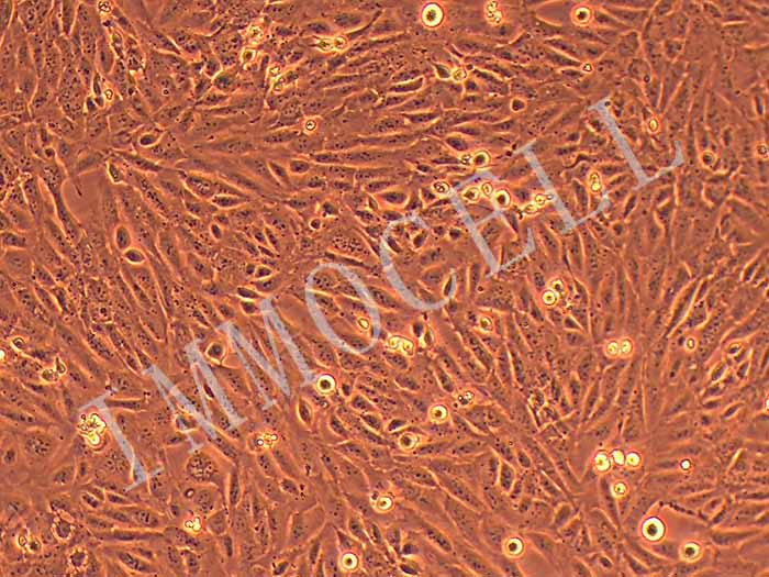 SV40-MES-13小鼠肾小球系膜细胞