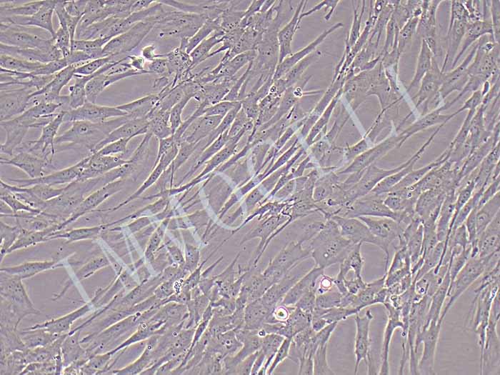 人子宫内膜上皮细胞永生化图片
