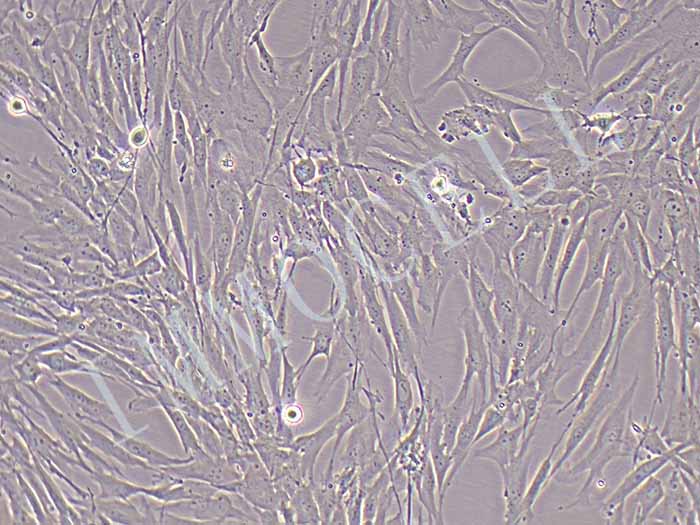 人子宫内膜上皮细胞永生化图片
