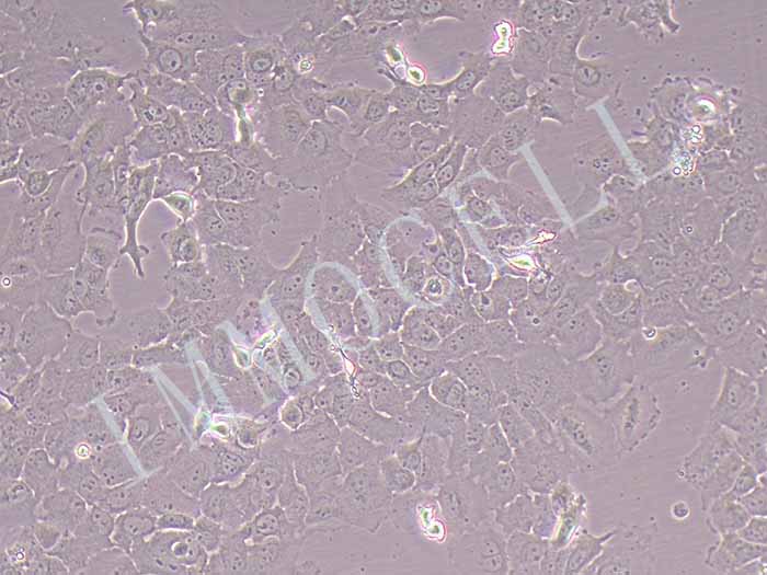人卵巢癌细胞图片