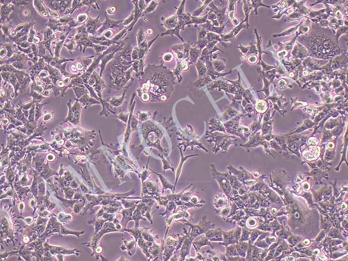 GL-261-LUC小鼠胶质细胞瘤-荧光素酶标记图片