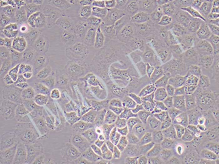 SW-13细胞细胞图片