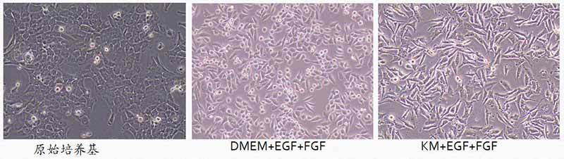 NP69使用不同培养基细胞形态不同图