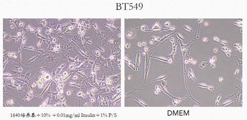 BT549使用不同培养基细胞形态不同图