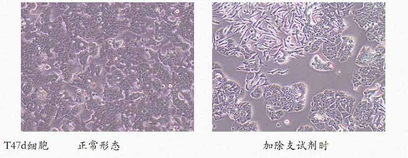 t47d细胞加药和正常形态对比图