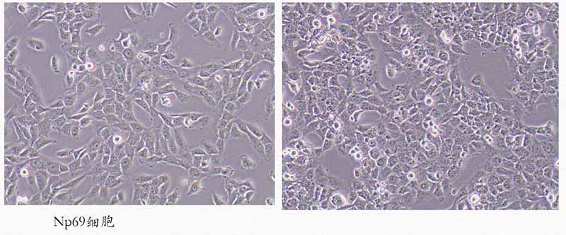 np69细胞状态改变图