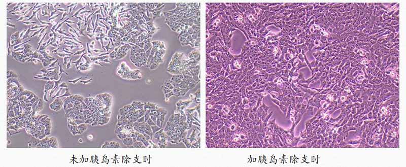 细胞加胰岛素和未加胰岛素对比图