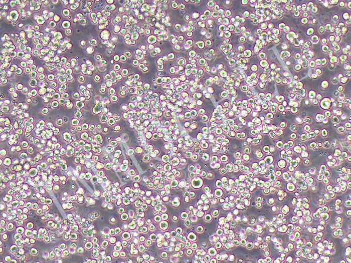 P3/NSI/1-Ag4-1[NS-1] 小鼠骨髓瘤细胞图片