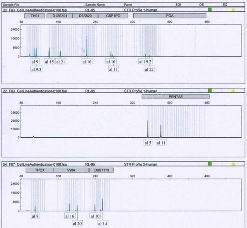 RL95-2人子宫内膜癌细胞STR鉴定位点图