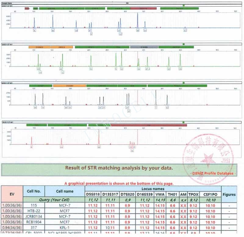 MCF-7人乳腺癌细胞STR鉴定位点图
