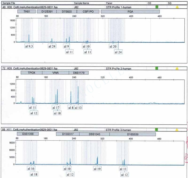 J82人膀胱移行细胞癌STR鉴定位点图