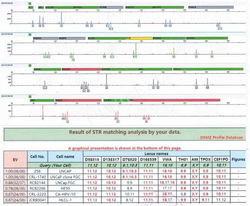 LNCAP人前列腺癌细胞STR鉴定位点图