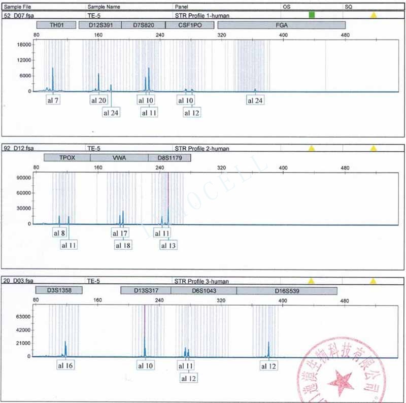 TE-1人食管癌细胞 STR鉴定位点图片