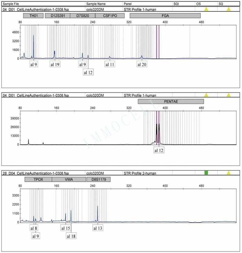 COLO 320DM人结直肠腺癌细胞STR鉴定位点图