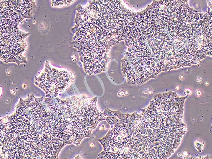 BT474细胞细胞图片