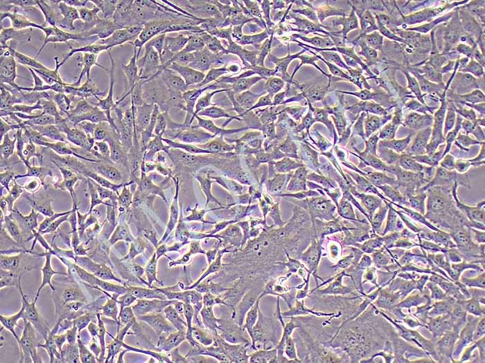 Calu-1细胞细胞图片