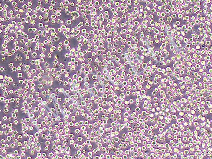 Kasumi-1细胞细胞图片