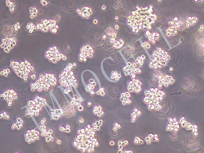 SU-DHL-6细胞细胞图片