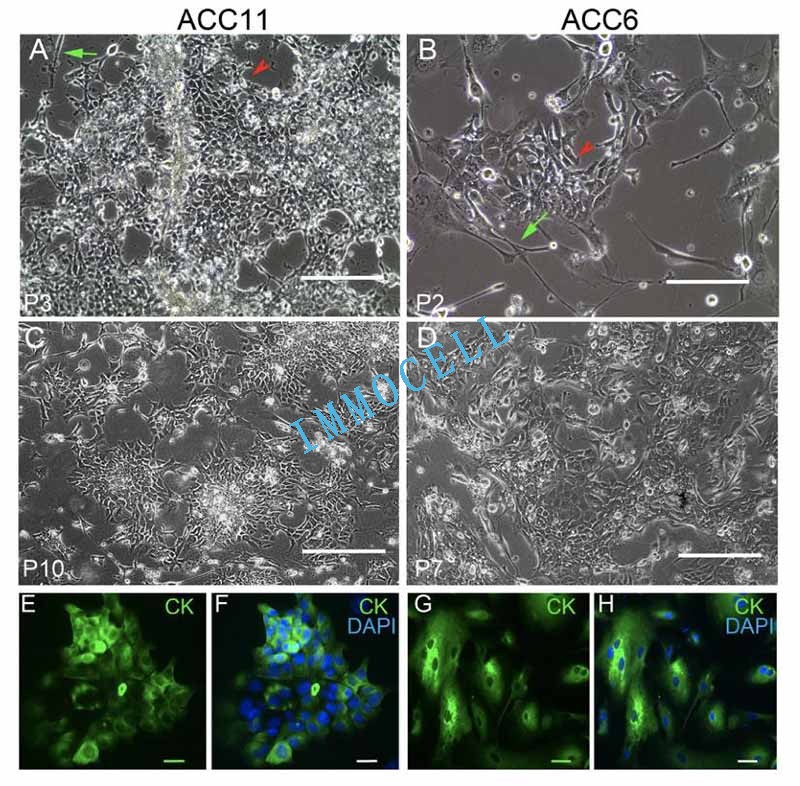 ACC细胞培养的形态学特征及其表达的表皮分子标志物图