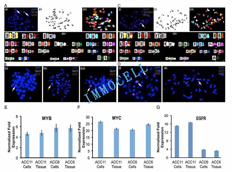 ACC培养细胞中保留MYB移位以及MYB，MYC和EGFP的表达图