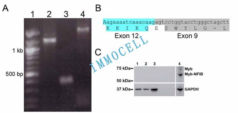 ACC11细胞中保留MYB-NFIB转录本及其融合蛋白图