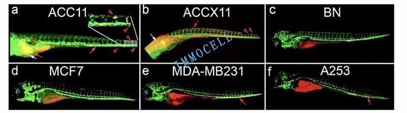 ACC11细胞在斑马鱼体转移模型中仍保持其转移能力图