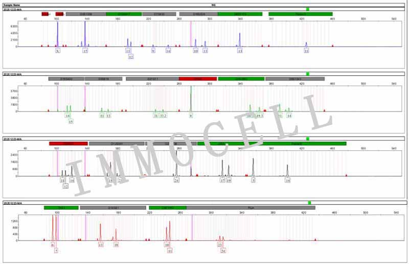 6T-CEM人T细胞白血病细胞STR鉴定图片