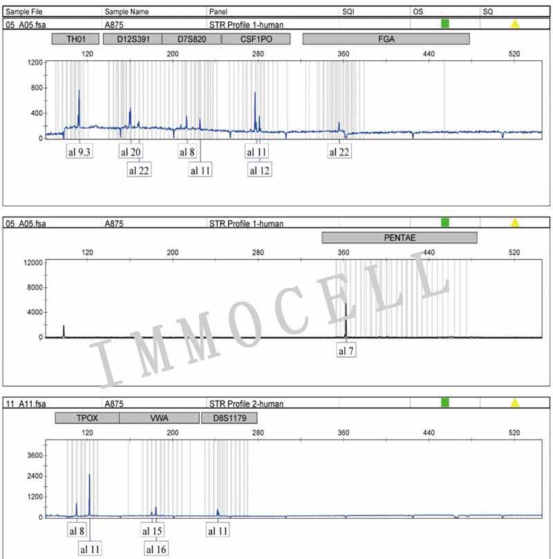 A875人黑色素瘤细胞STR鉴定图片