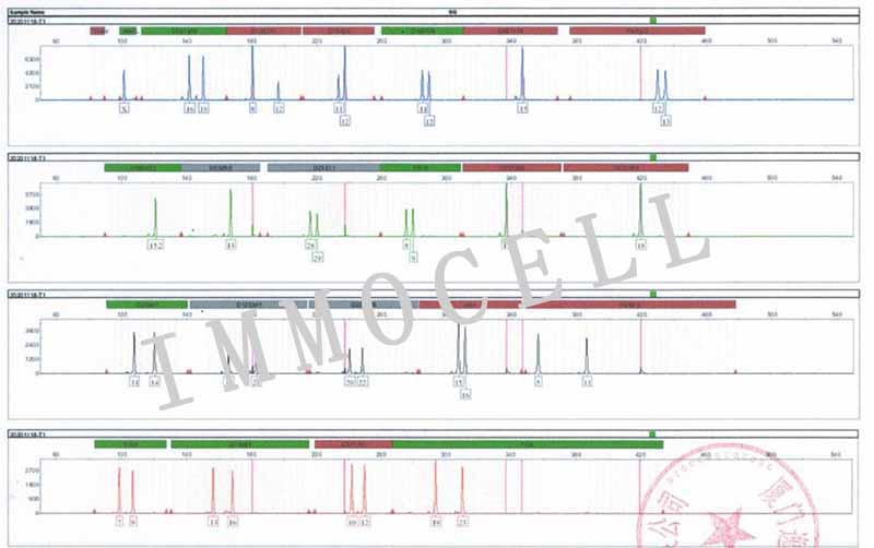 CA46(人Burkitt's淋巴瘤细胞)STR鉴定图片