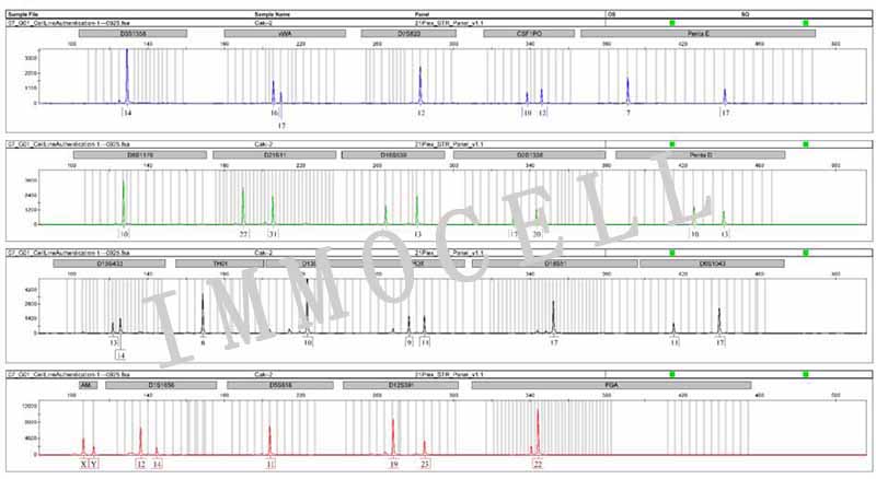 Caki-2人肾透明细胞癌细胞STR鉴定图片