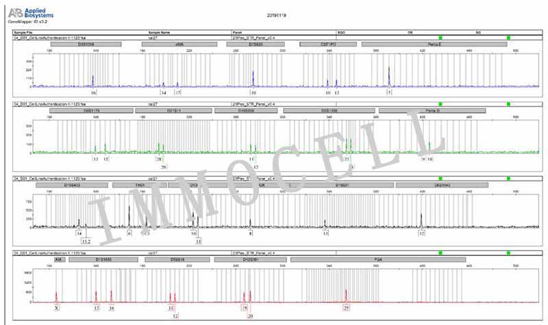 CAL-27人舌鳞癌细胞STR鉴定图片