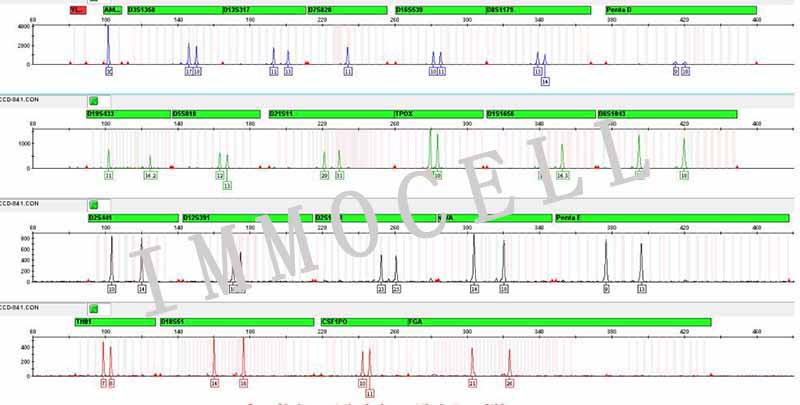 CCD-841CoN人正常结肠上皮细胞STR鉴定图片
