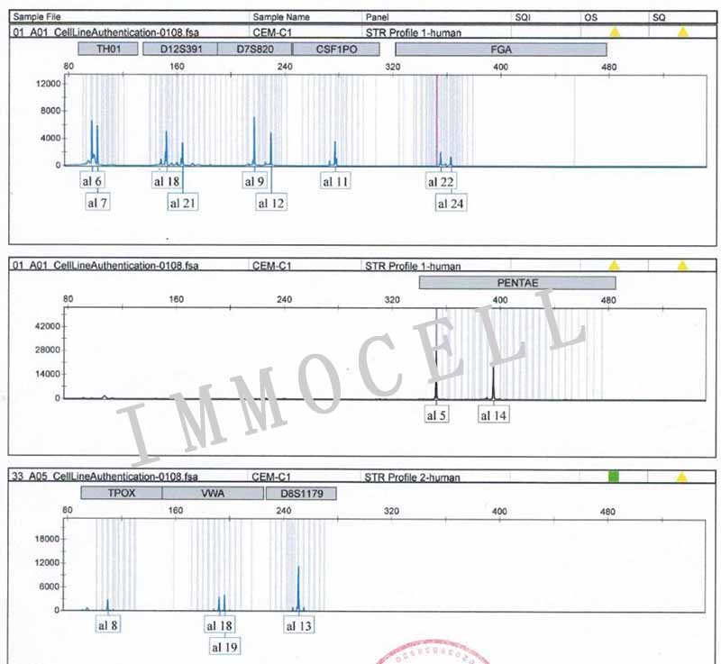 CEM/C1人急性淋巴细胞白血病细胞STR鉴定图片