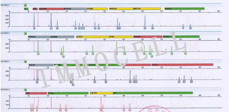 CNE1人鼻咽癌细胞STR鉴定图片