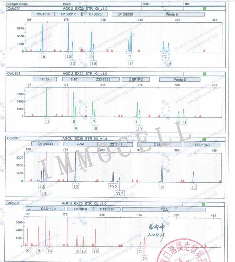 COLO 201人结直肠腺癌细胞STR鉴定图片