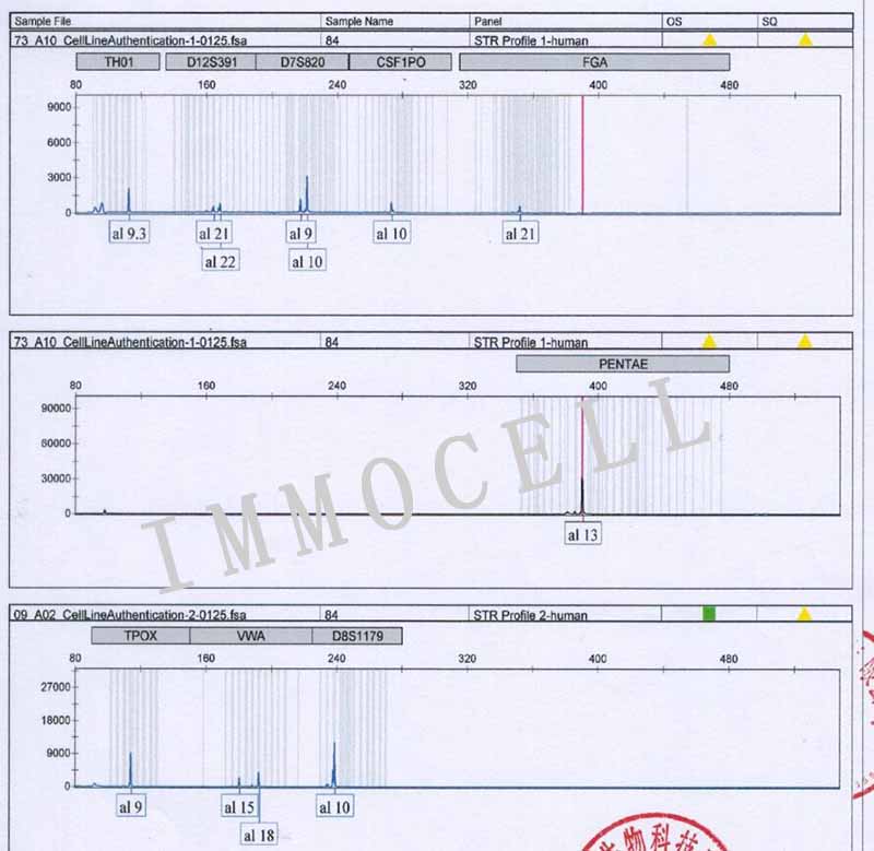 FTC-133人滤泡状甲状腺癌细胞STR鉴定图片