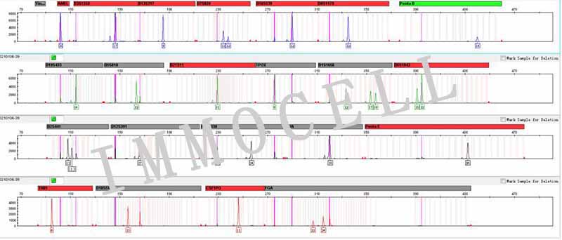 HCC827人非小细胞肺癌细胞STR鉴定图片