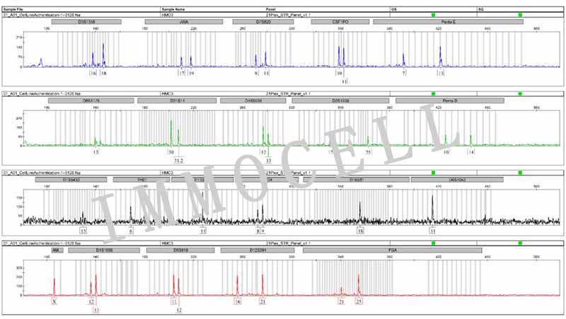 HMC3人小胶质细胞STR鉴定图片
