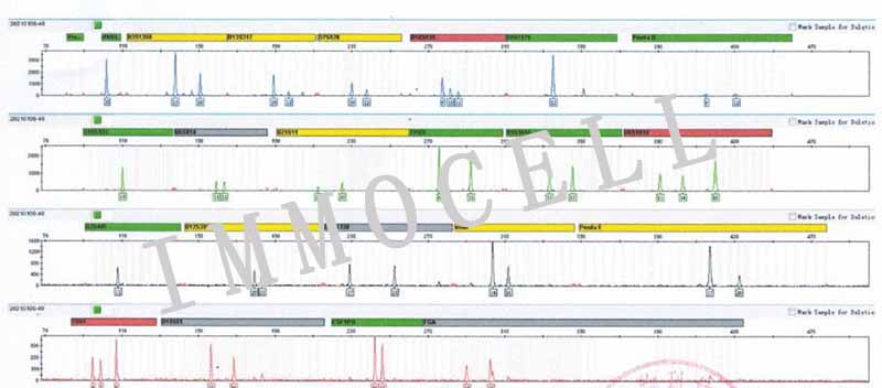 hne-2人鼻咽癌细胞株STR鉴定图片