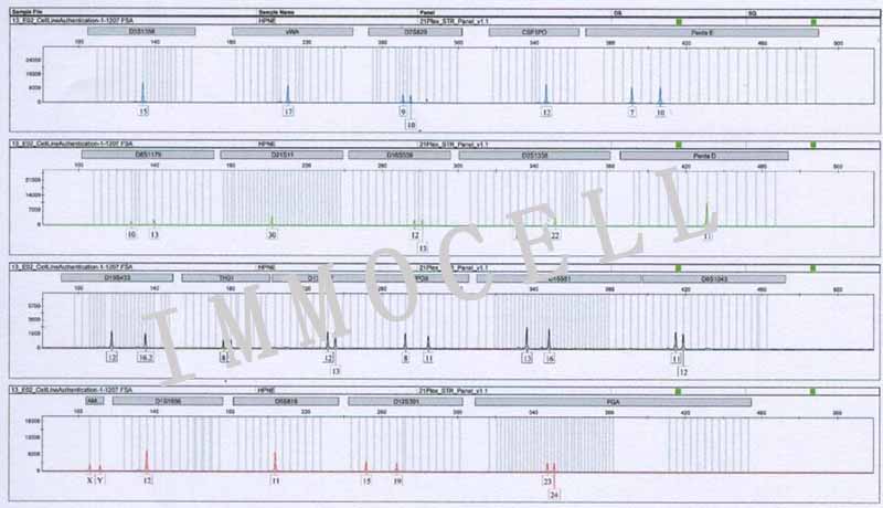 hTERT-HPNE人胰腺导管上皮细胞STR鉴定图片