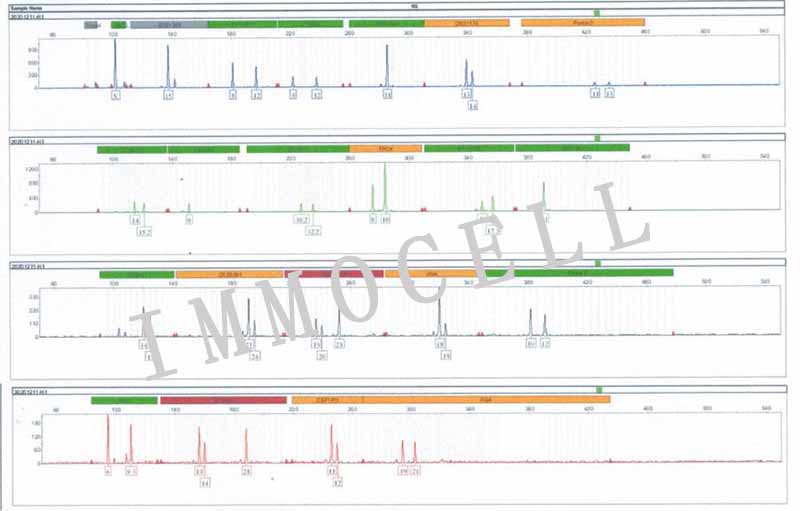J.gamma1人急性T细胞白血病细胞STR鉴定图片