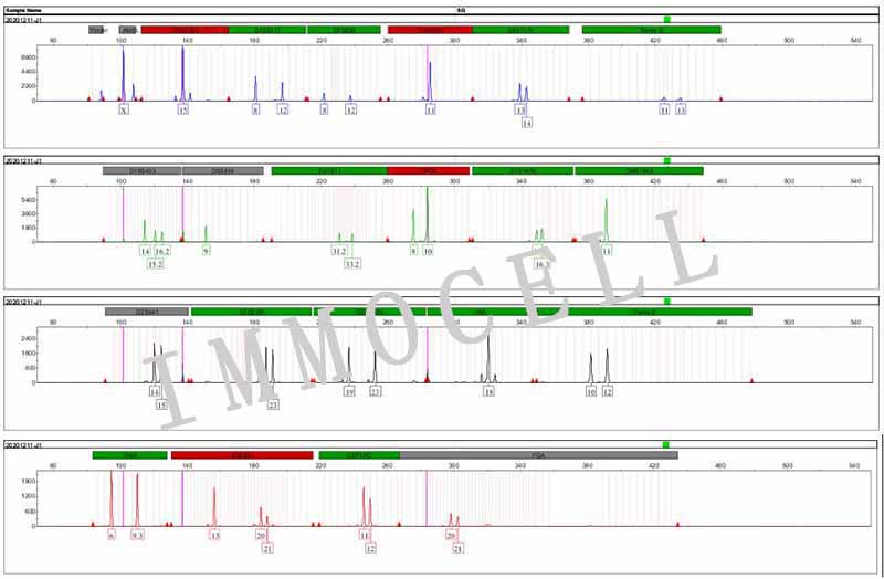 Jurkat Clone E6-1人T淋巴细胞白血病细胞STR鉴定图片