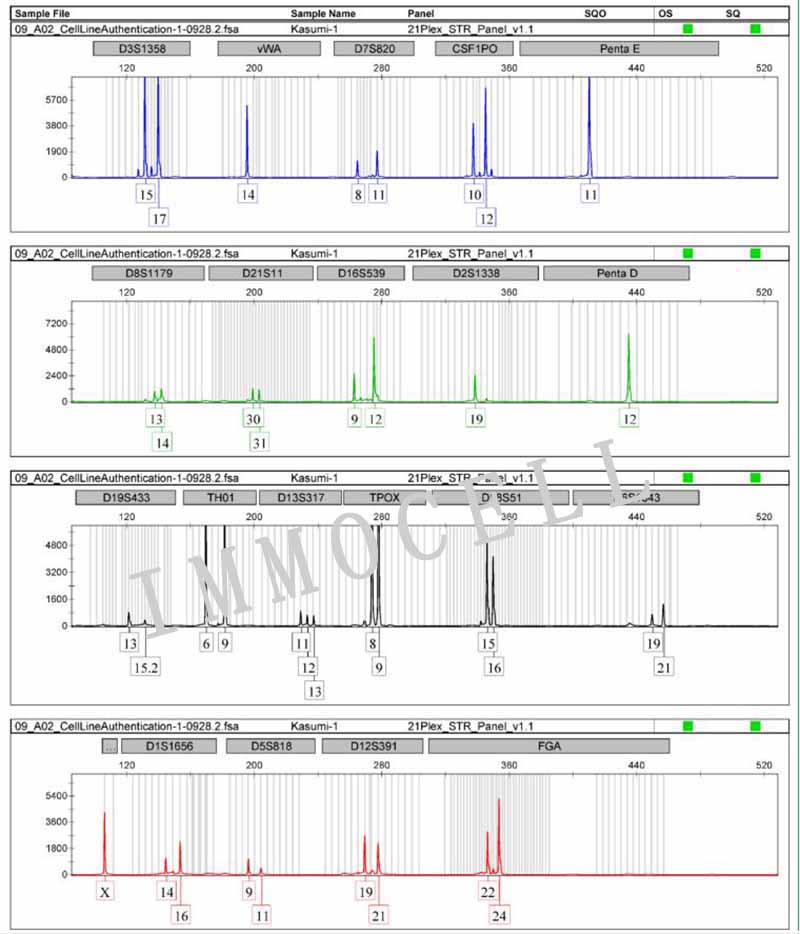 Kasumi-1人急性原粒细胞白血病细胞STR鉴定图片