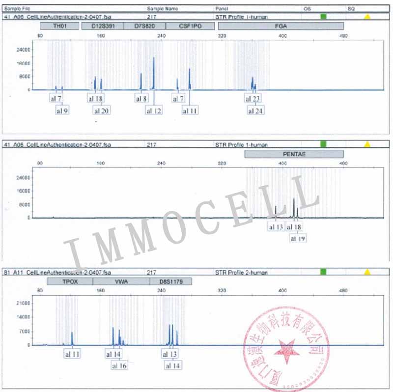 KATO III人胃癌细胞STR鉴定图片