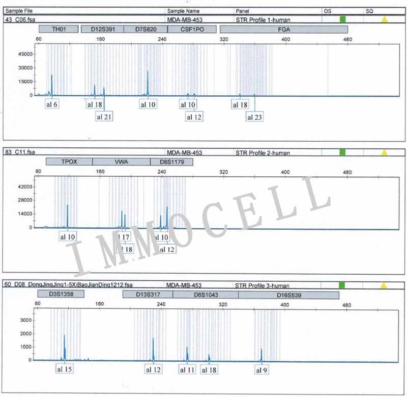MDA-MB-453人乳腺癌细胞STR鉴定图片